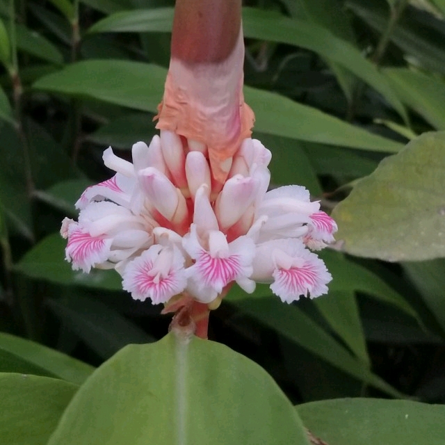 宝宝黄疸值偏高